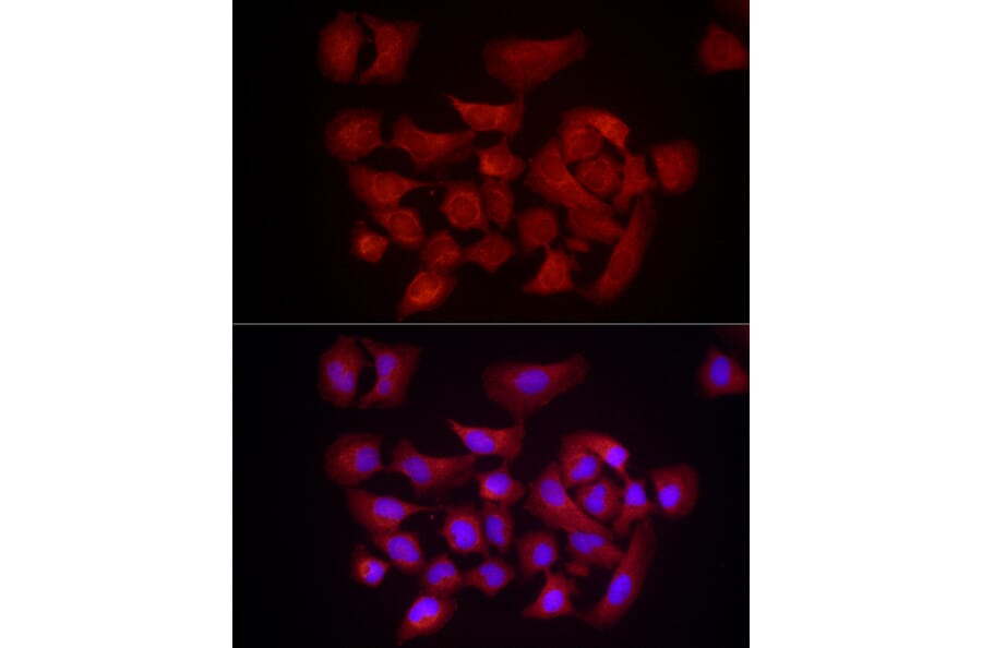Immunofluorescence - Anti-DUSP8 Antibody (A93212) - Antibodies.com