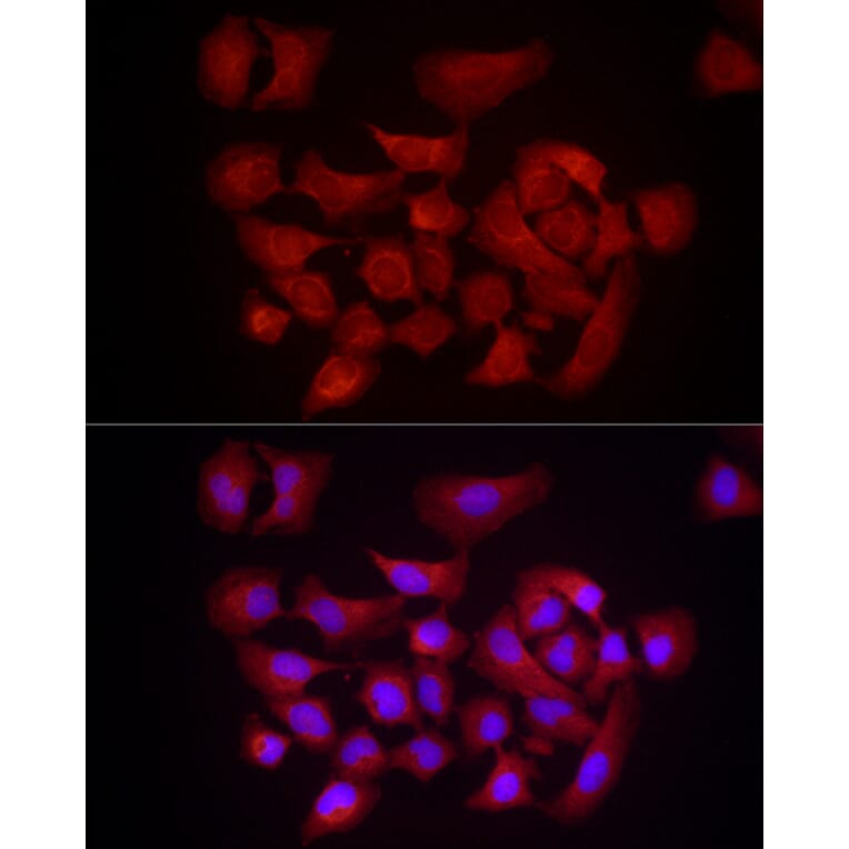 Immunofluorescence - Anti-DUSP8 Antibody (A93212) - Antibodies.com