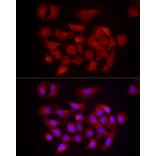 Immunofluorescence - Anti-DUSP8 Antibody (A93212) - Antibodies.com
