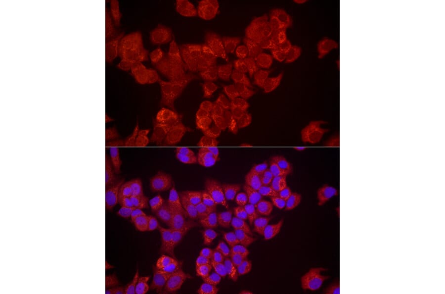 Immunofluorescence - Anti-DUSP8 Antibody (A93212) - Antibodies.com