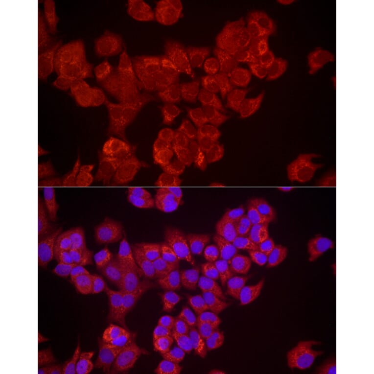 Immunofluorescence - Anti-DUSP8 Antibody (A93212) - Antibodies.com