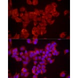 Immunofluorescence - Anti-DUSP8 Antibody (A93212) - Antibodies.com