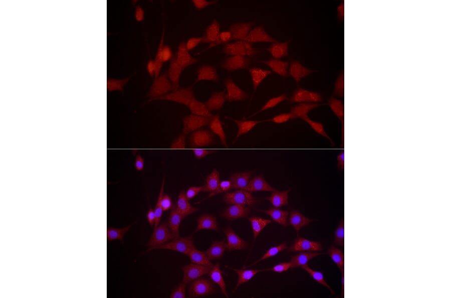 Immunofluorescence - Anti-DUSP8 Antibody (A93212) - Antibodies.com