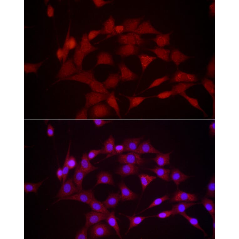 Immunofluorescence - Anti-DUSP8 Antibody (A93212) - Antibodies.com