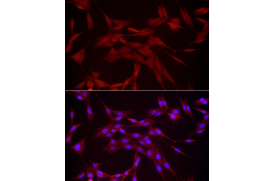 Immunofluorescence - Anti-DUSP8 Antibody (A93212) - Antibodies.com