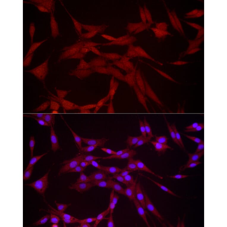 Immunofluorescence - Anti-DUSP8 Antibody (A93212) - Antibodies.com