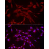 Immunofluorescence - Anti-DUSP8 Antibody (A93212) - Antibodies.com