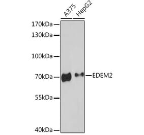 Western Blot - Anti-EDEM2 Antibody (A93213) - Antibodies.com