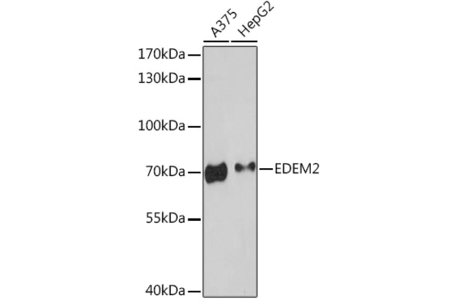 Western Blot - Anti-EDEM2 Antibody (A93213) - Antibodies.com