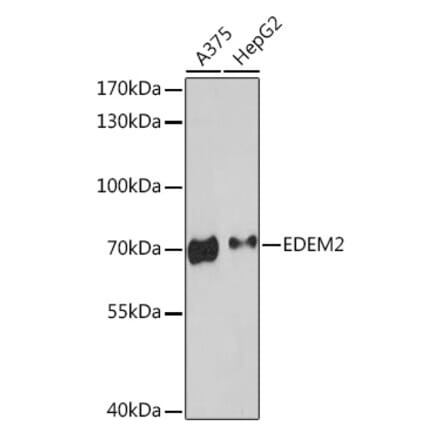 Western Blot - Anti-EDEM2 Antibody (A93213) - Antibodies.com