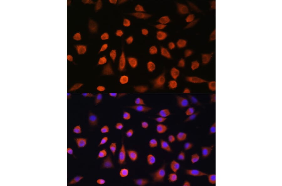Immunofluorescence - Anti-EDEM2 Antibody (A93213) - Antibodies.com