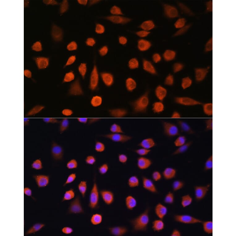 Immunofluorescence - Anti-EDEM2 Antibody (A93213) - Antibodies.com