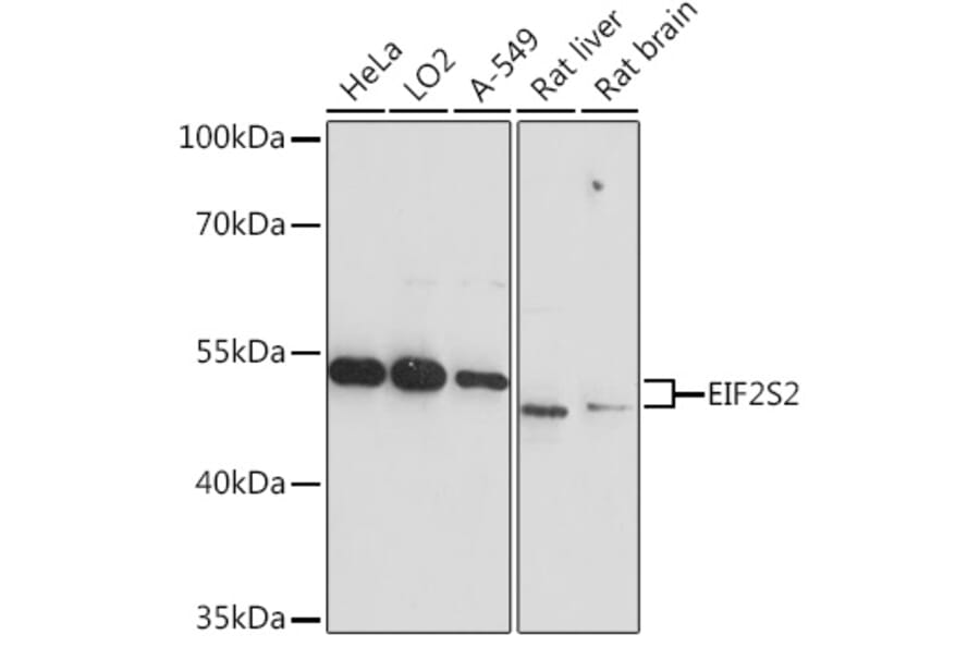 Western Blot - Anti-EIF2S2/EIF2B Antibody (A93215) - Antibodies.com