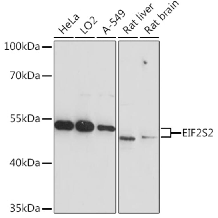 Western Blot - Anti-EIF2S2/EIF2B Antibody (A93215) - Antibodies.com