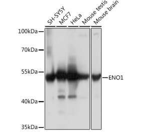 Western Blot - Anti-ENO1 Antibody (A93216) - Antibodies.com