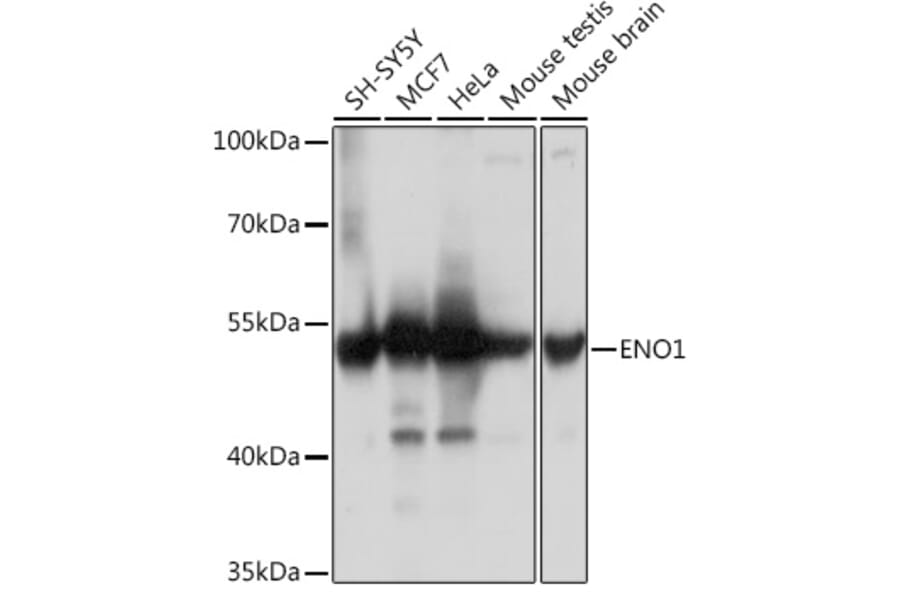 Western Blot - Anti-ENO1 Antibody (A93216) - Antibodies.com