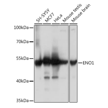 Western Blot - Anti-ENO1 Antibody (A93216) - Antibodies.com