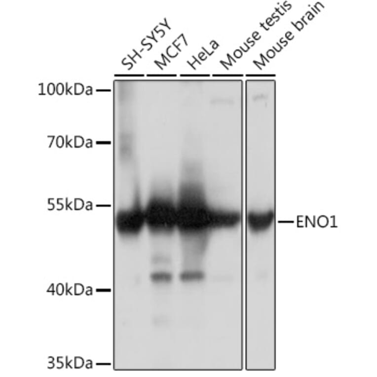 Western Blot - Anti-ENO1 Antibody (A93216) - Antibodies.com