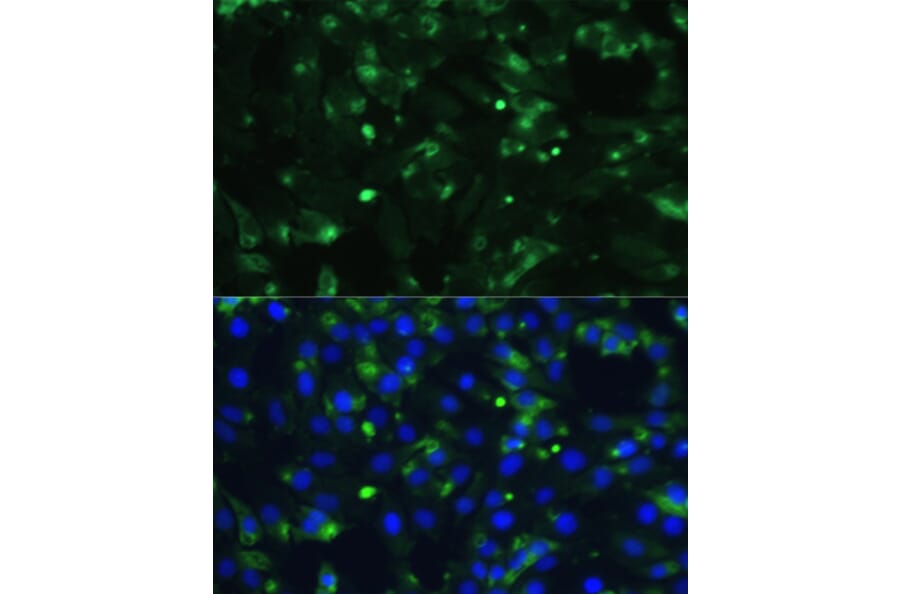 Immunofluorescence - Anti-ENO1 Antibody (A93216) - Antibodies.com