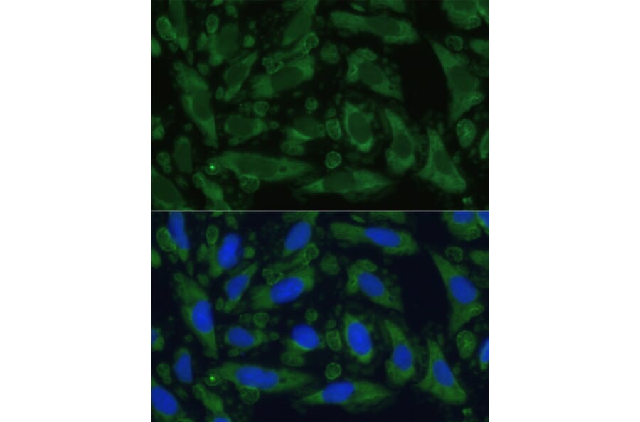 Immunofluorescence - Anti-ENO1 Antibody (A93216) - Antibodies.com