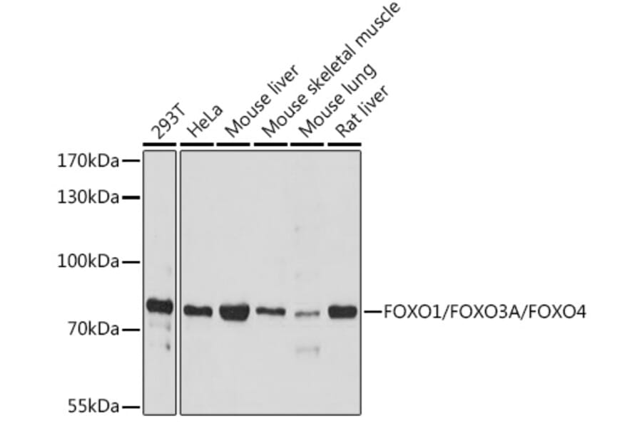 Western Blot - Anti-FOXO1A + FOXO3A + FOXO4/AFX Antibody (A93221) - Antibodies.com
