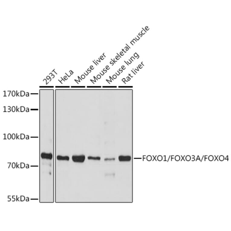 Western Blot - Anti-FOXO1A + FOXO3A + FOXO4/AFX Antibody (A93221) - Antibodies.com