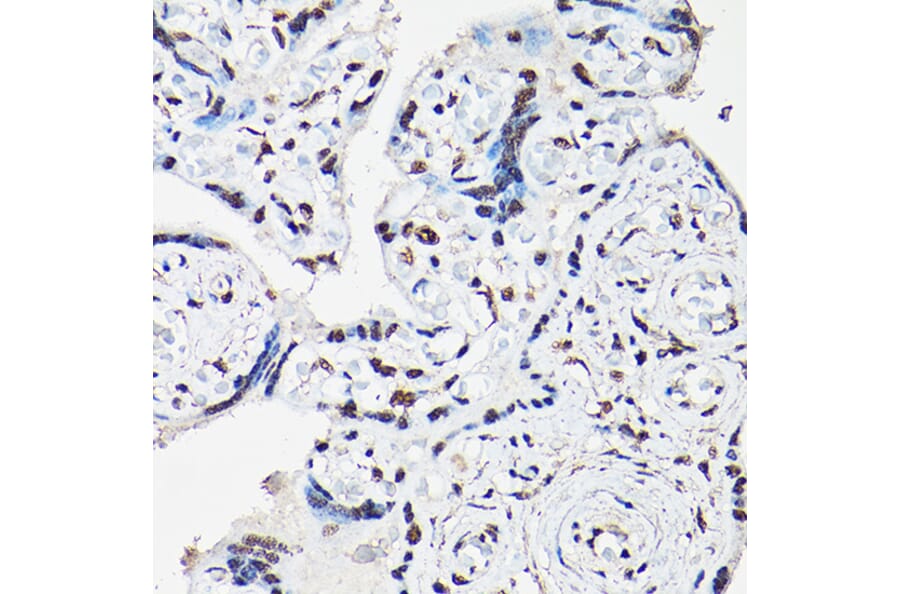 Immunohistochemistry - Anti-FOXO1A + FOXO3A + FOXO4/AFX Antibody (A93221) - Antibodies.com