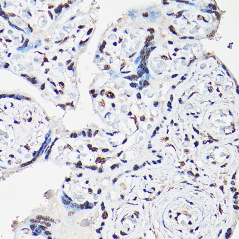 Immunohistochemistry - Anti-FOXO1A + FOXO3A + FOXO4/AFX Antibody (A93221) - Antibodies.com