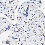 Immunohistochemistry - Anti-FOXO1A + FOXO3A + FOXO4/AFX Antibody (A93221) - Antibodies.com