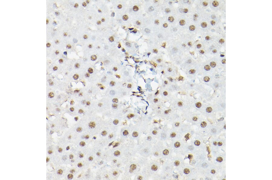 Immunohistochemistry - Anti-FOXO1A + FOXO3A + FOXO4/AFX Antibody (A93221) - Antibodies.com