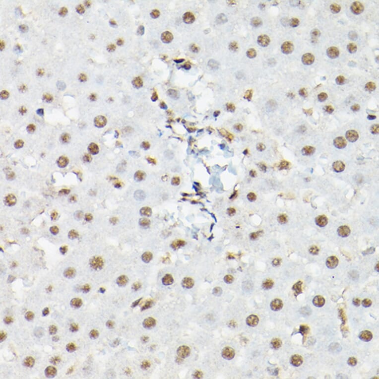 Immunohistochemistry - Anti-FOXO1A + FOXO3A + FOXO4/AFX Antibody (A93221) - Antibodies.com