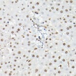 Immunohistochemistry - Anti-FOXO1A + FOXO3A + FOXO4/AFX Antibody (A93221) - Antibodies.com