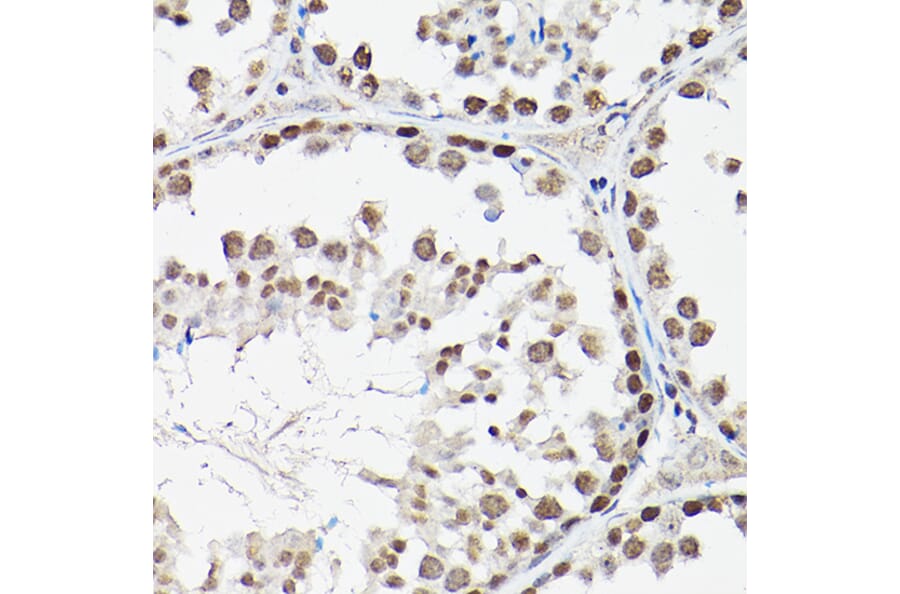 Immunohistochemistry - Anti-FOXO1A + FOXO3A + FOXO4/AFX Antibody (A93221) - Antibodies.com