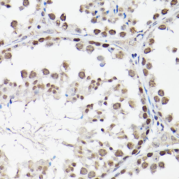 Immunohistochemistry - Anti-FOXO1A + FOXO3A + FOXO4/AFX Antibody (A93221) - Antibodies.com