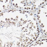 Immunohistochemistry - Anti-FOXO1A + FOXO3A + FOXO4/AFX Antibody (A93221) - Antibodies.com