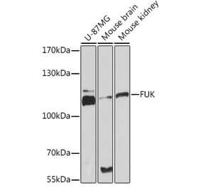 Western Blot - Anti-FUK Antibody (A93222) - Antibodies.com