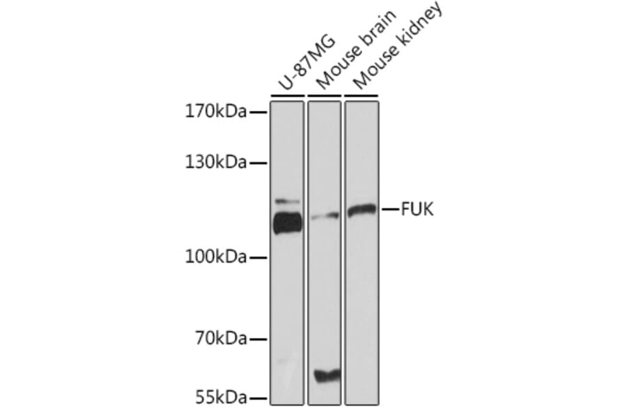 Western Blot - Anti-FUK Antibody (A93222) - Antibodies.com
