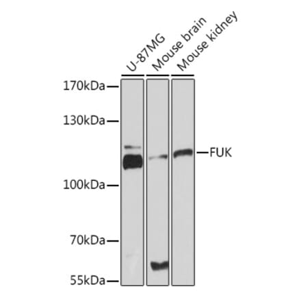 Western Blot - Anti-FUK Antibody (A93222) - Antibodies.com