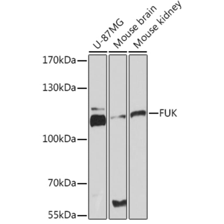 Western Blot - Anti-FUK Antibody (A93222) - Antibodies.com