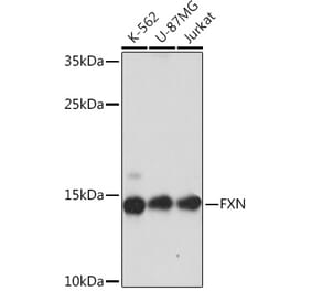 Western Blot - Anti-Frataxin Antibody (A93224) - Antibodies.com