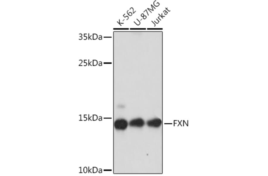Western Blot - Anti-Frataxin Antibody (A93224) - Antibodies.com