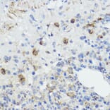 Immunohistochemistry - Anti-Frataxin Antibody (A93224) - Antibodies.com