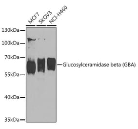 Western Blot - Anti-GBA Antibody (A93225) - Antibodies.com