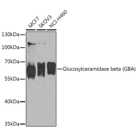 Western Blot - Anti-GBA Antibody (A93225) - Antibodies.com