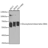 Western Blot - Anti-GBA Antibody (A93225) - Antibodies.com
