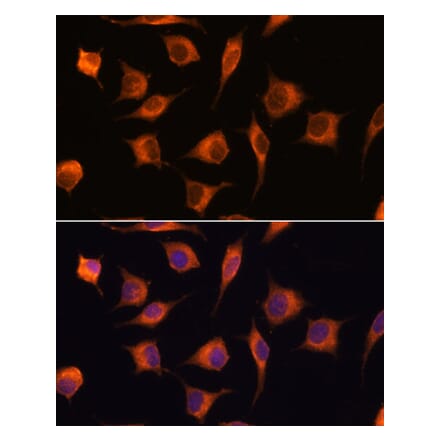 Immunofluorescence - Anti-GBAS Antibody (A93226) - Antibodies.com