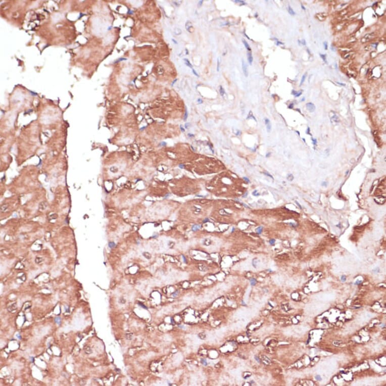 Immunohistochemistry - Anti-Gemin 5 Antibody (A93227) - Antibodies.com