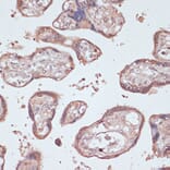 Immunohistochemistry - Anti-Gemin 5 Antibody (A93227) - Antibodies.com