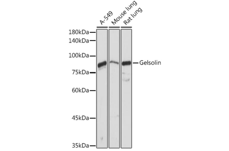 Western Blot - Anti-Gelsolin Antibody (A93230) - Antibodies.com
