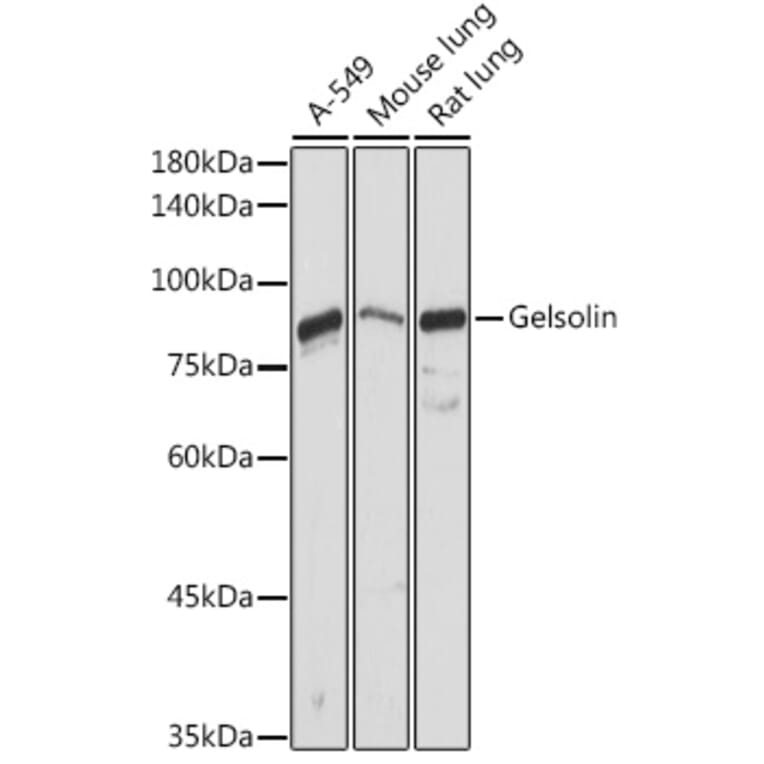 Western Blot - Anti-Gelsolin Antibody (A93230) - Antibodies.com